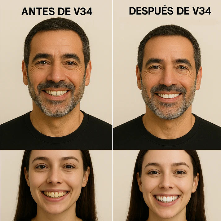 Blanqueador Dental V34 Acción Inmediata - Vitacore